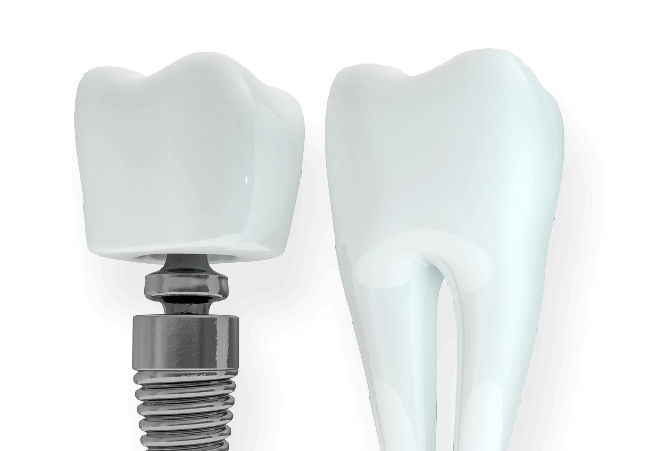 Why Choose Dental Ariston